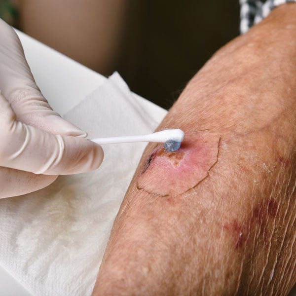 basic wound care